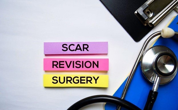 What You Need to Know About Scar Revision